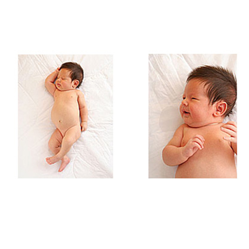 12 อาการผิดปกติที่พบได้ในลูกอ่อน (แรกเกิด - 3 เดือน) 