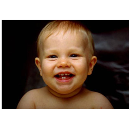 อาการไม่สบายเพราะฟันจะขึ้นของลูก