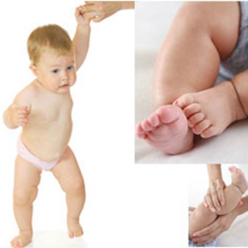 โรคเบล้าท์ กระดูกโก่ง จากน้ำหนักเกิน