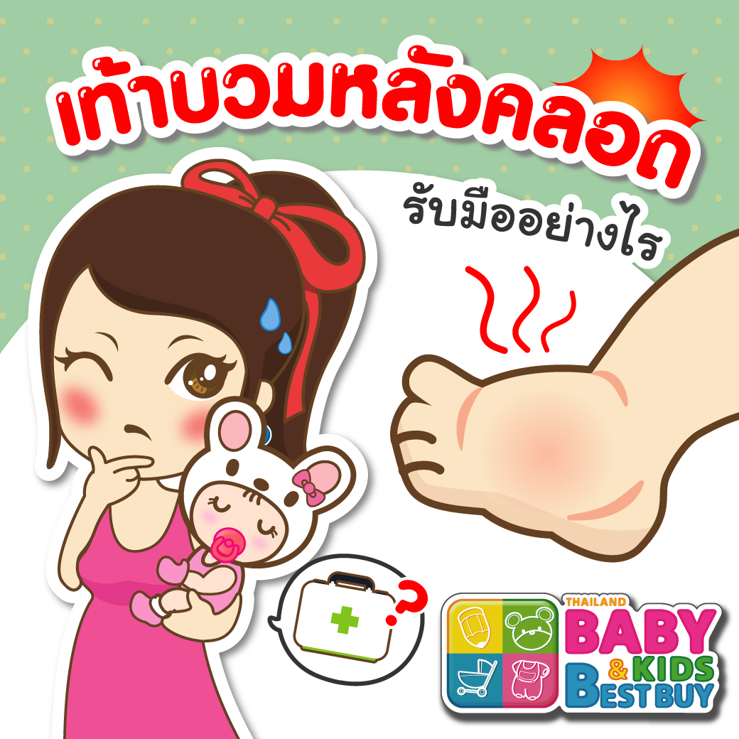 เท้าบวมหลังคลอด รับมืออย่างไร ?