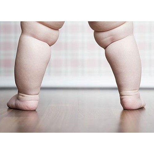 เด็กอ้วน (Obese Children)